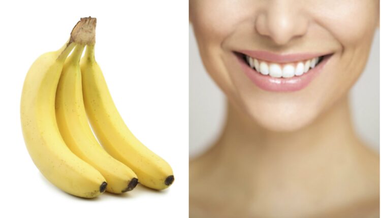 الموز والأبتسامة